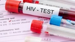 Эпидемия ВИЧ в России набирает обороты
