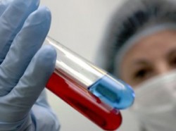 России угрожает «птичий грипп» России угрожает «птичий грипп»