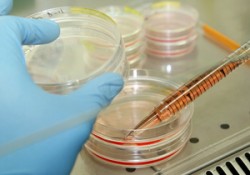 Число жертв E.coli возросло до 26 Число жертв E.coli возросло до 26