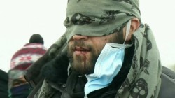 Беженцы в Кале зашили себе рты в знак протеста Беженцы в Кале зашили себе рты в знак протеста