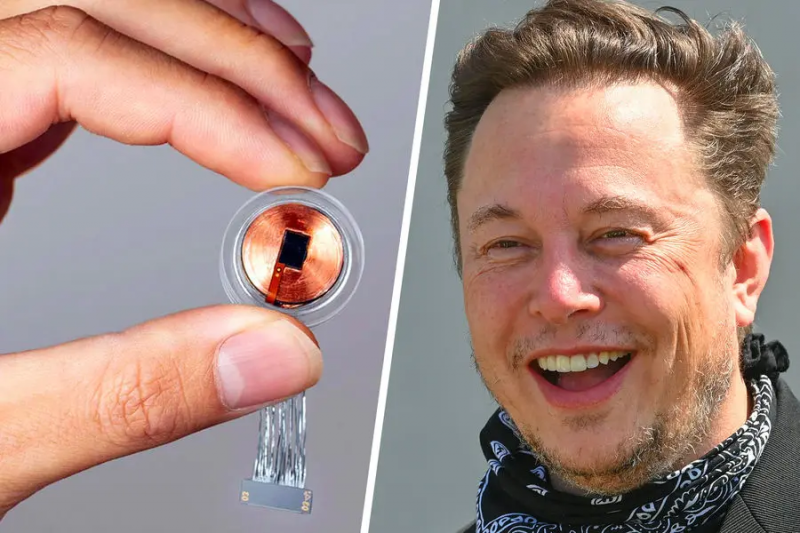Neuralink вживила первый имплант в мозг человека