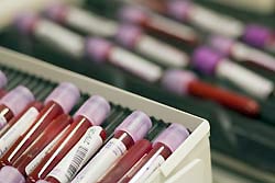 Российских спортсменок наказали за допинг Российских спортсменок наказали за допинг