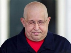 Чавес еще поборется за жизнь Чавес еще поборется за жизнь
