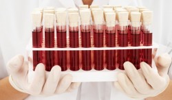 Ученые обнаружили новые группы крови