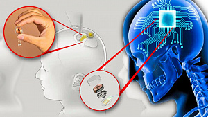 Компания Илона Маска начнёт испытывать чипы для мозга на людях